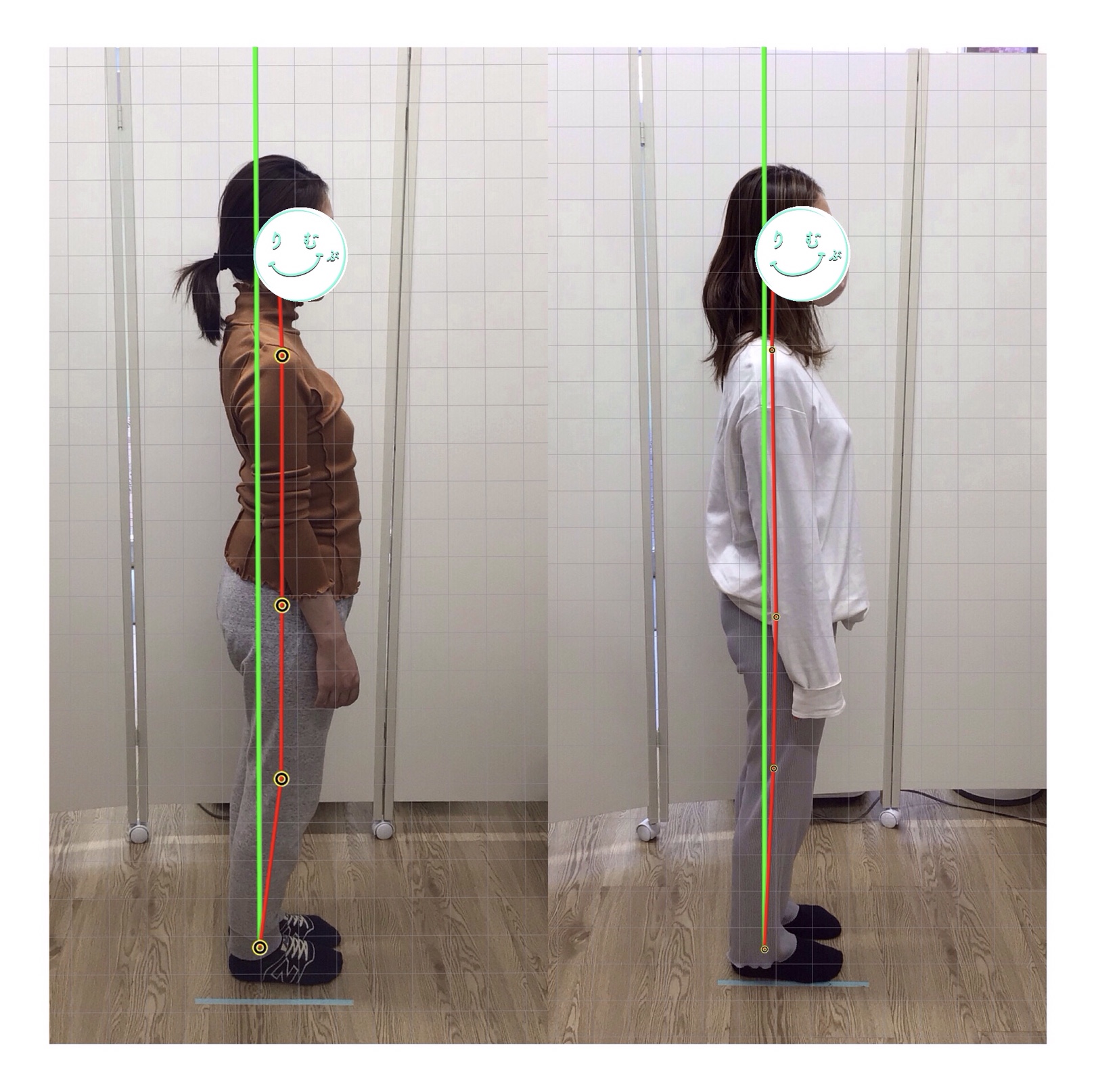 ビフォーアフター①側面・姿勢改善