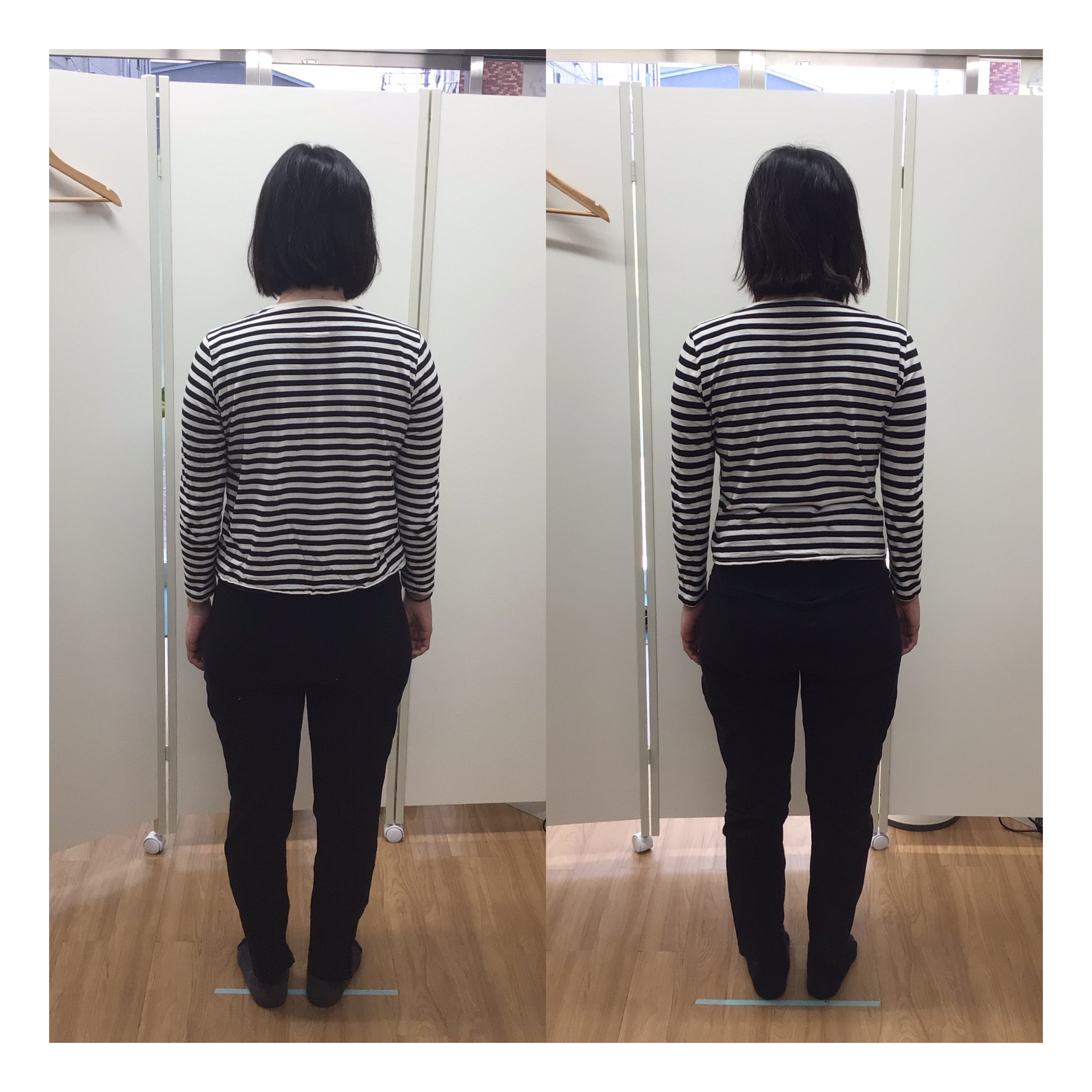 ビフォーアフター②背面・肩の歪み改善