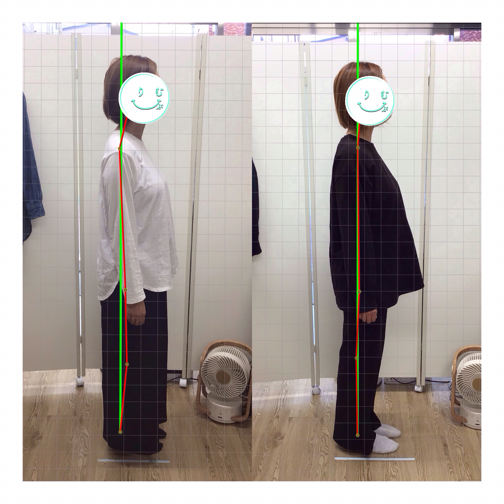ビフォーアフター④側面・猫背改善